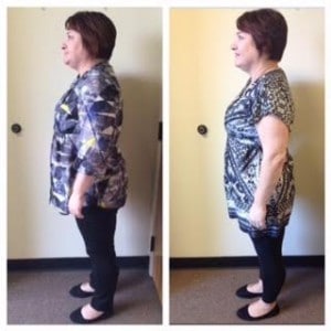 Chiropractic Overland Park KS Weight Loss Female Patient
