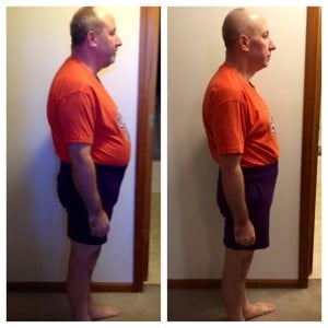 Chiropractic Overland Park KS Weight Loss Male Patient Chiropractic Overland Park KS Weight Loss Male Patient